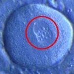 zygote 01