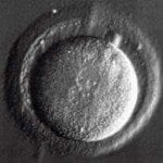 zygote 02